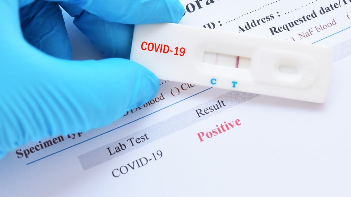Event goers and staff should complete a COVID test